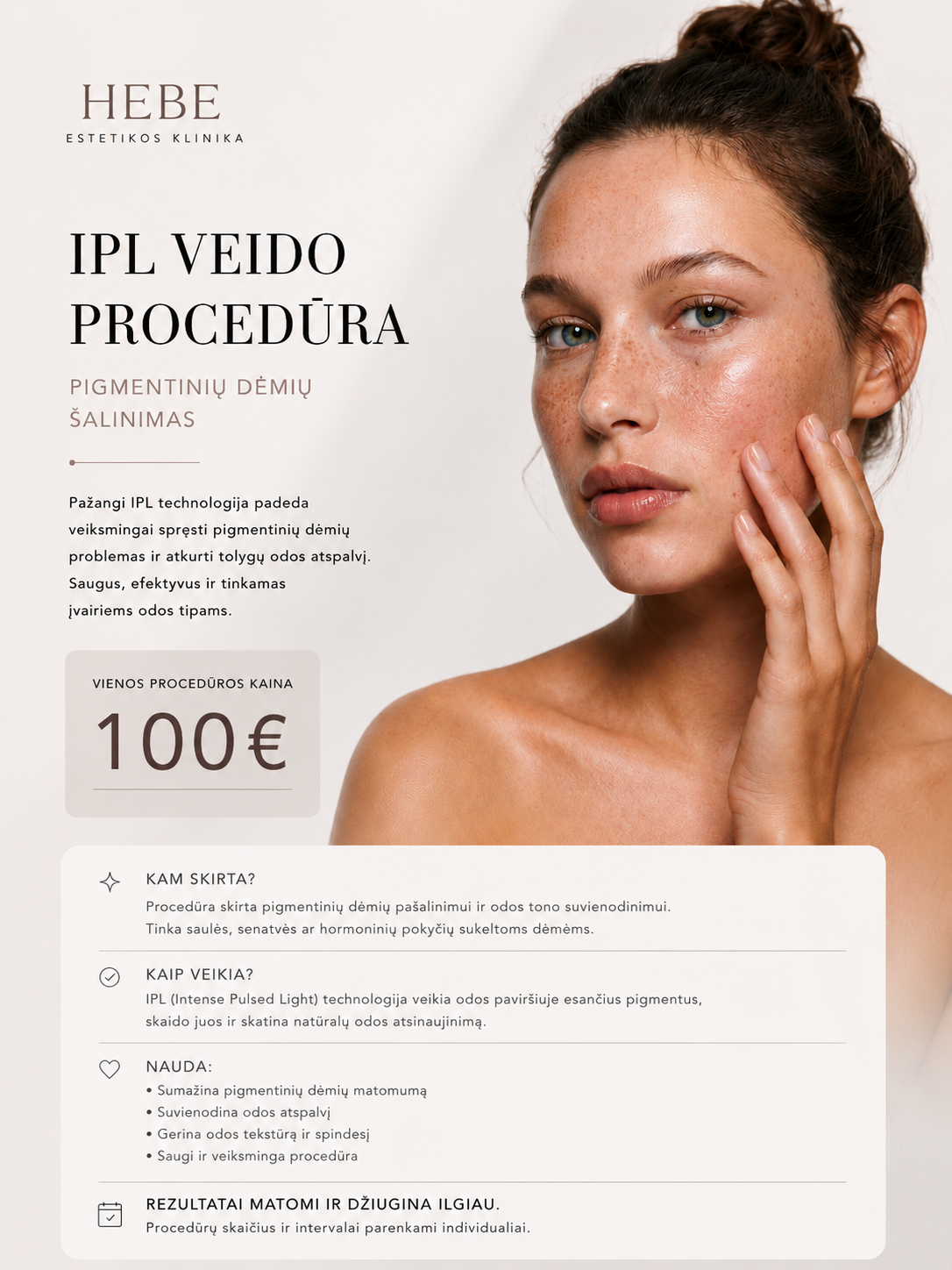 IPL pigmentinių dėmių šalinimas