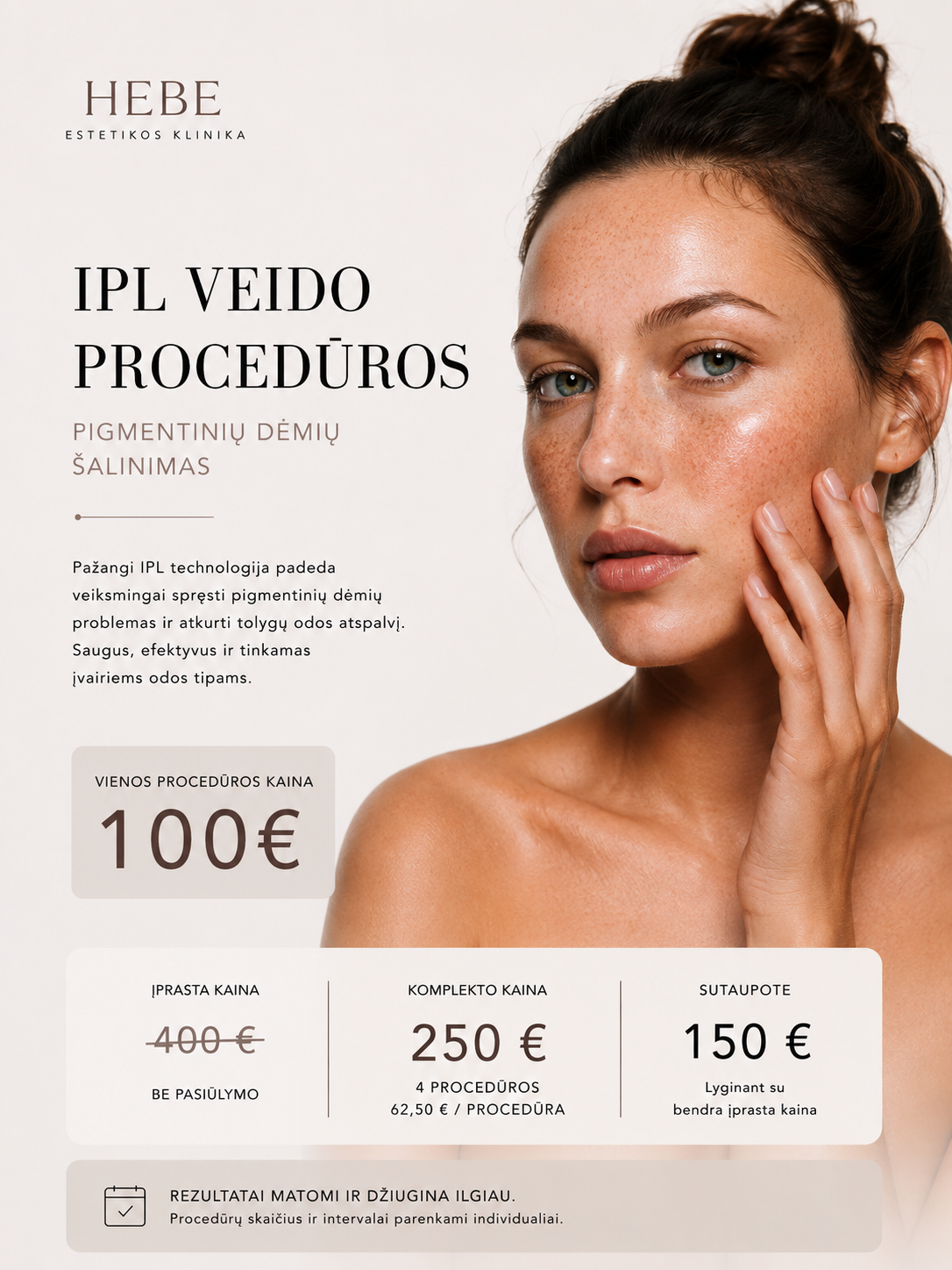 IPL pigmentinių dėmių šalinimas – 4 procedūrų kursas
