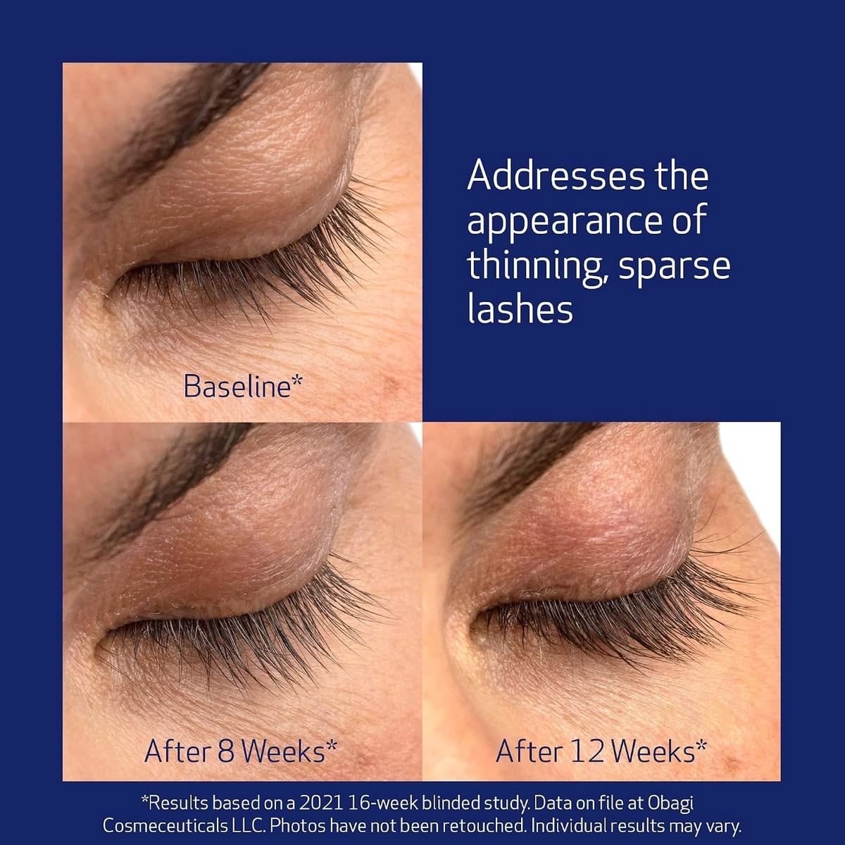Nu-Cil® Eyelash Enhancing Serum - Serumas | Skatinantis Blakstienų Augimą